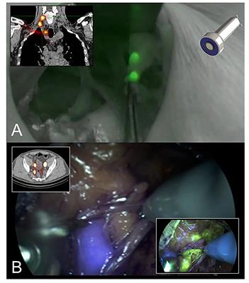 Editorial: State-Of-The-Art Fluorescence Image-Guided Surgery: Current and Future Developments